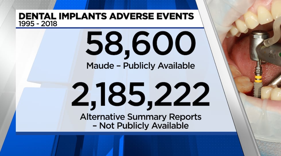 Out of 2.9 million adverse events from dental implants from 1995 to 2021, there is a failure...