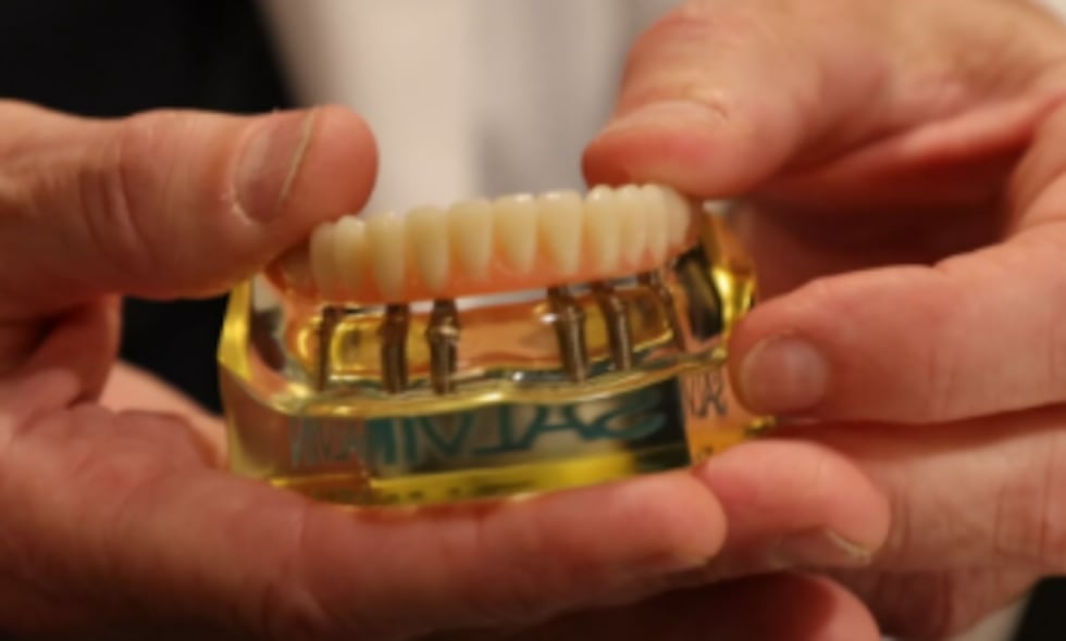 Dr. Terry Work shows components of dental implants.