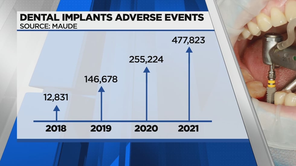 This is a graphic that shows adverse effects from dental implants have skyrocketed since 2018....