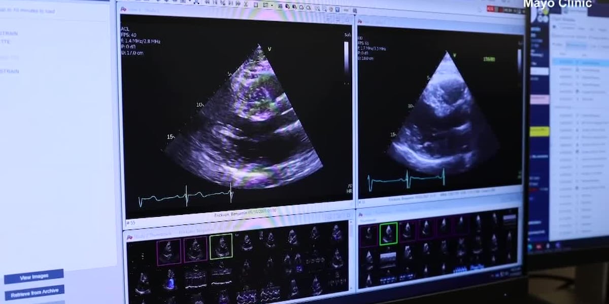 Mayo Clinic using AI to find hidden heart conditions